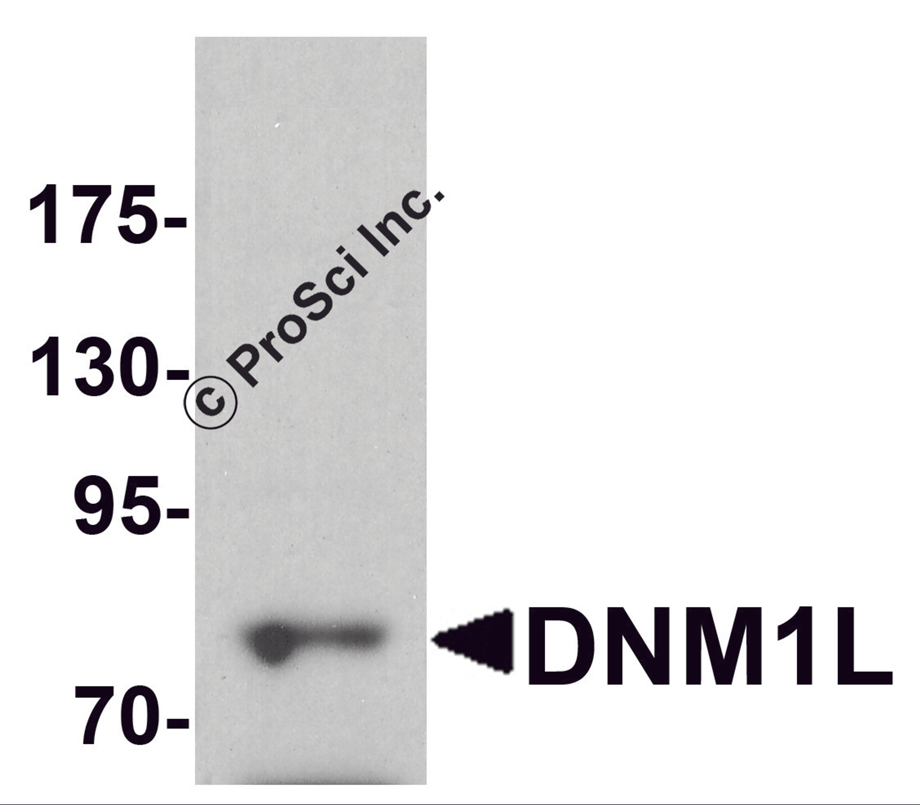 Western blot analysis of DNM1L in HeLa cell lysate with DNM1L antibody at 1 μg/ml.