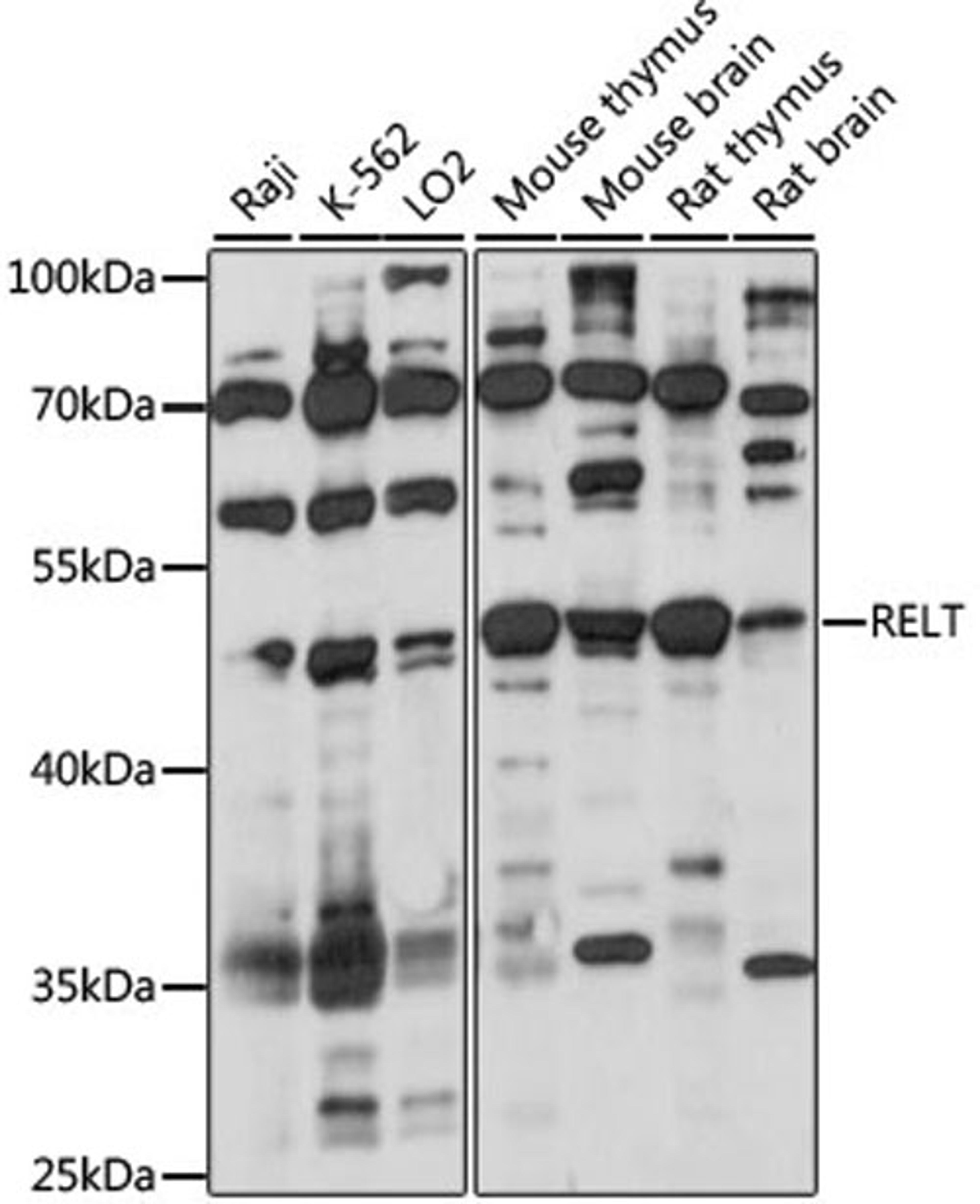 Western blot - RELT antibody (A15540)