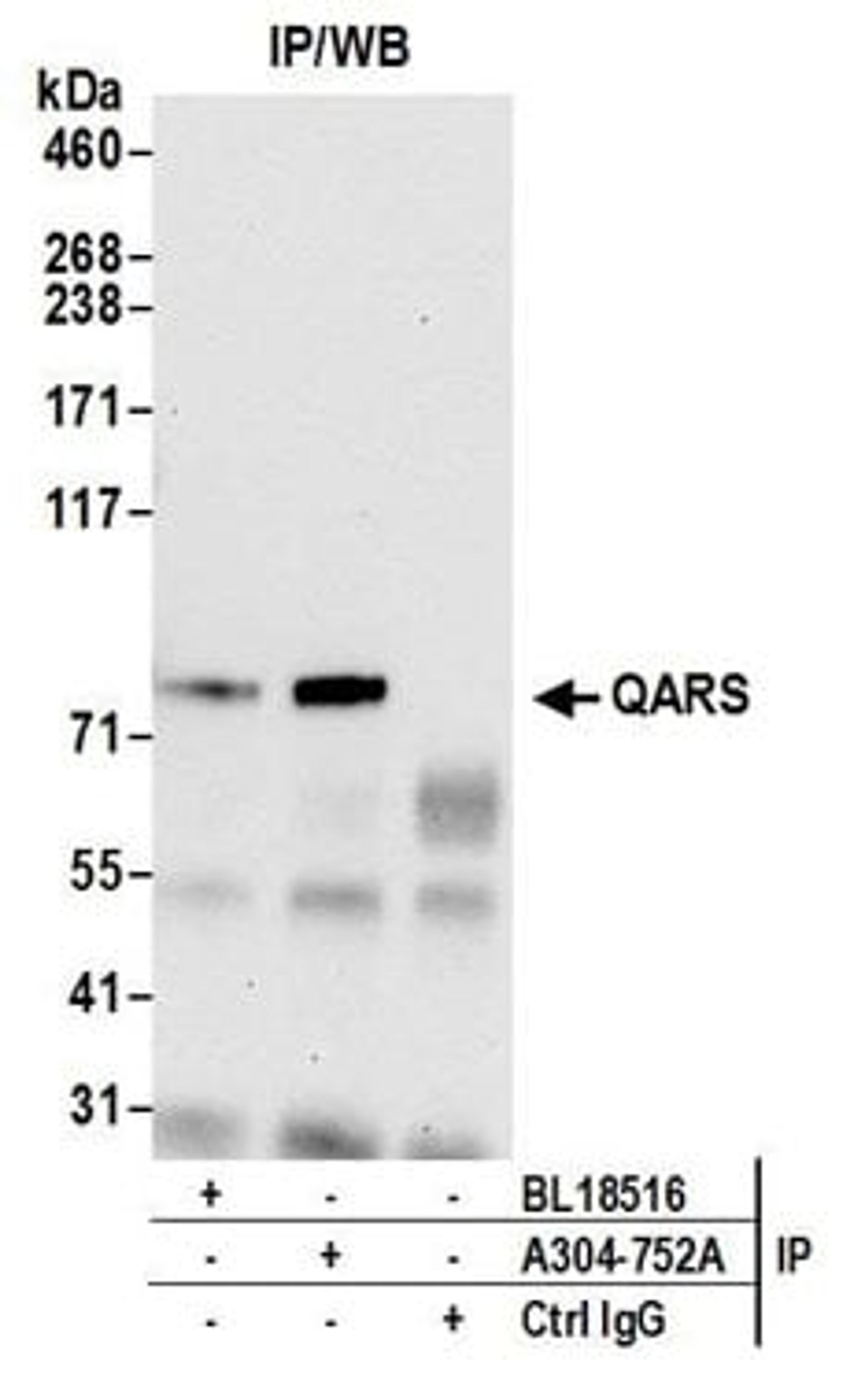 Detection of human QARS by western blot of immunoprecipitates.