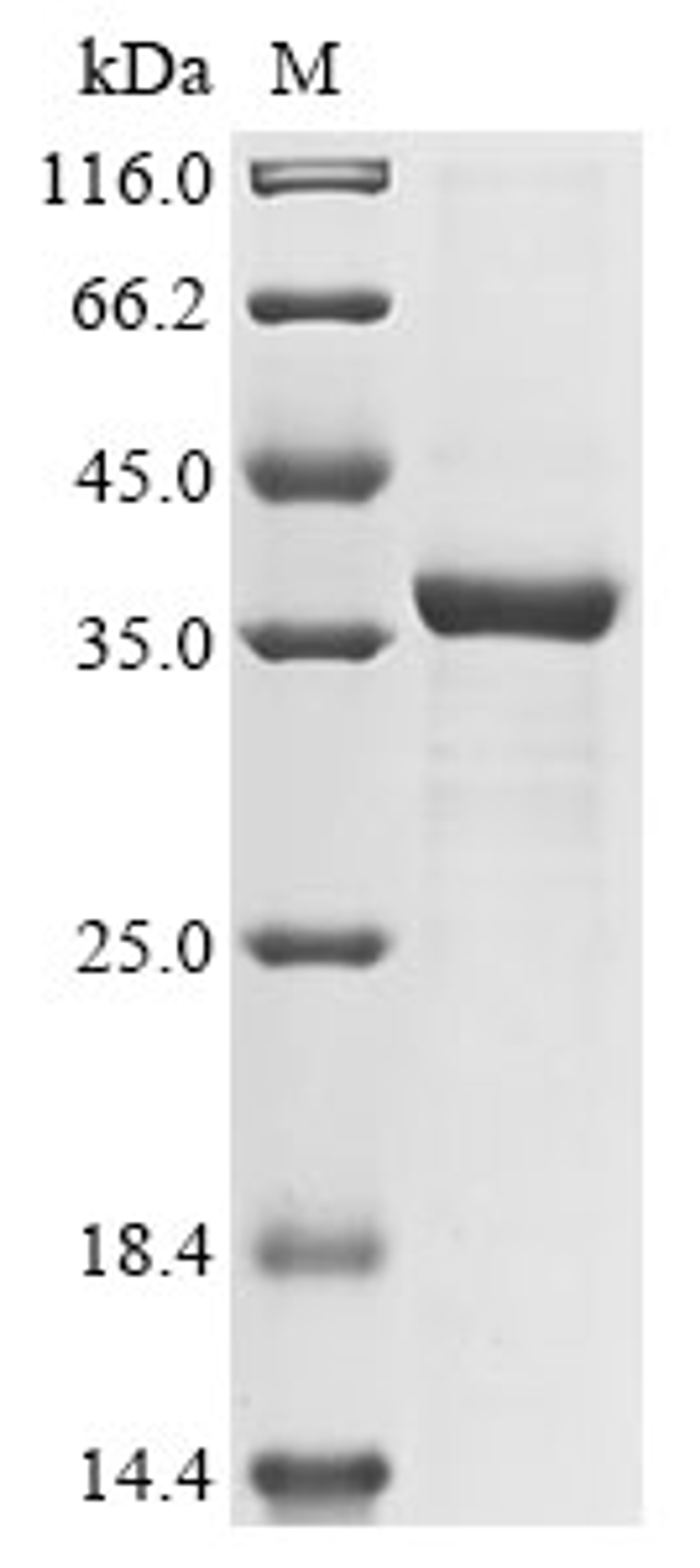 (Tris-Glycine gel) Discontinuous SDS-PAGE (reduced) with 5% enrichment gel and 15% separation gel.