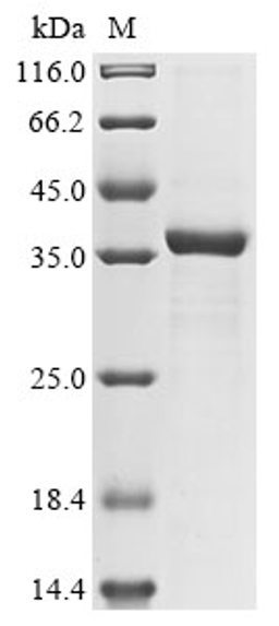 (Tris-Glycine gel) Discontinuous SDS-PAGE (reduced) with 5% enrichment gel and 15% separation gel.