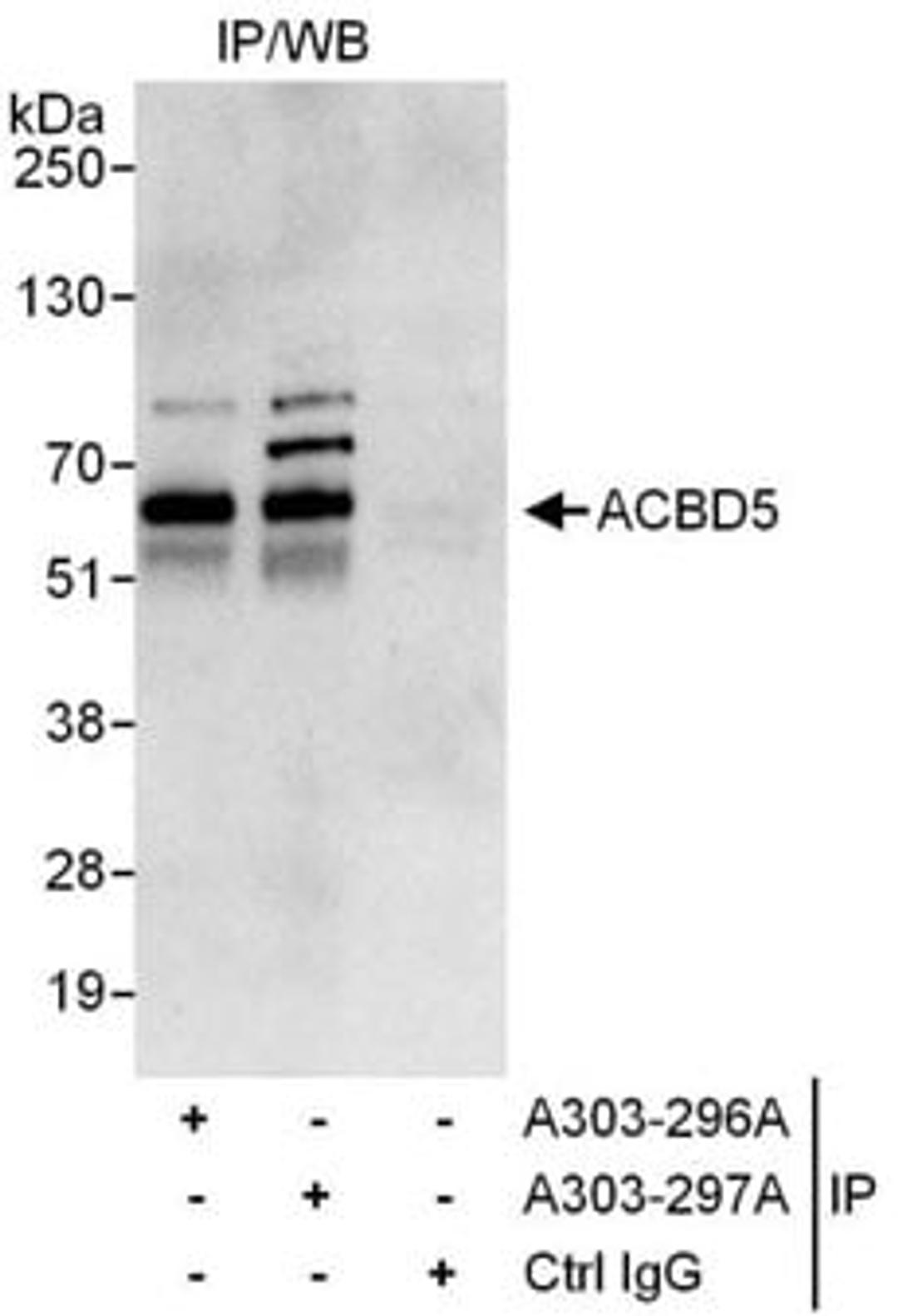 Detection of human ACBD5 by western blot of immunoprecipitates.