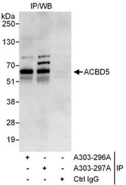 Detection of human ACBD5 by western blot of immunoprecipitates.