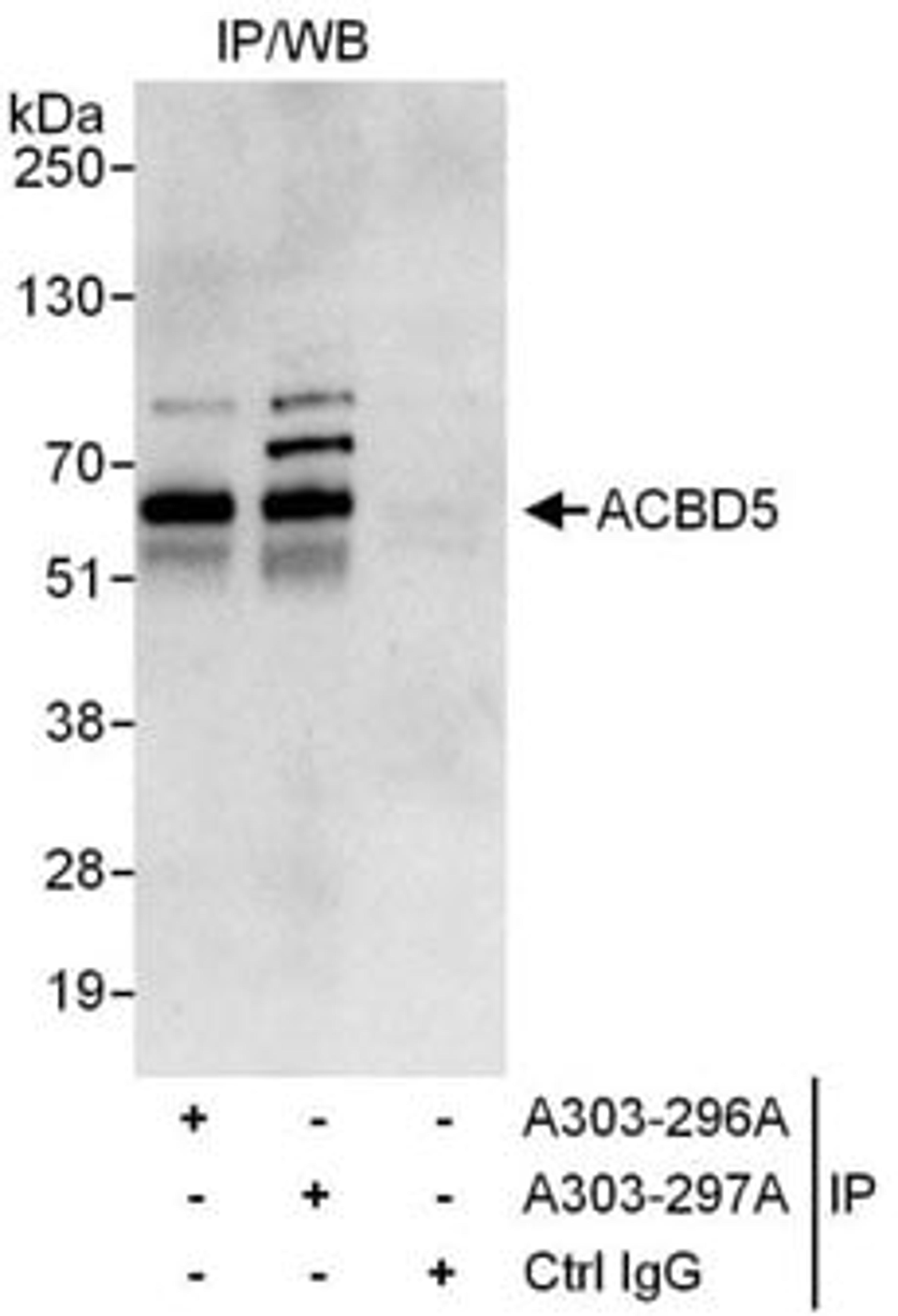 Detection of human ACBD5 by western blot of immunoprecipitates.