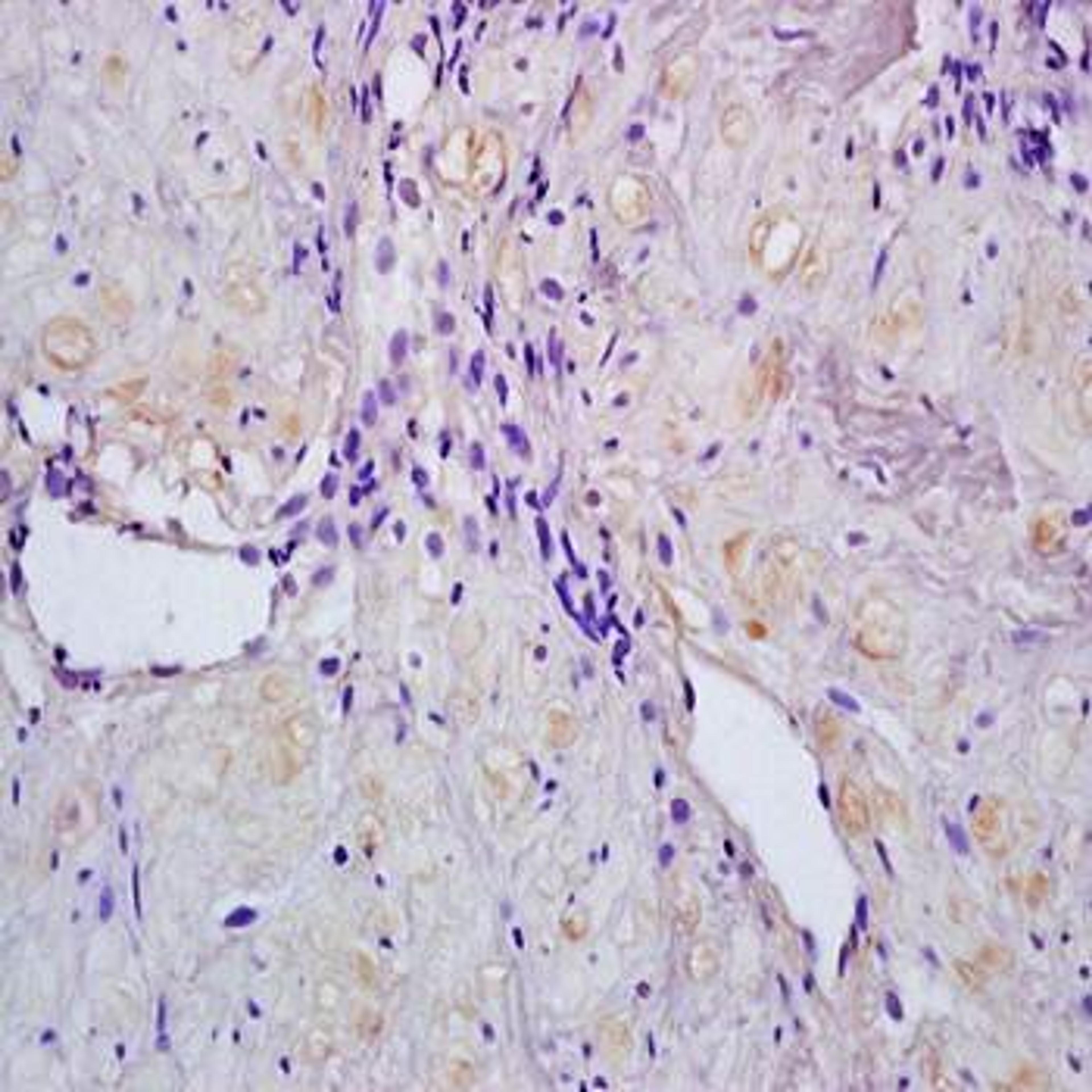 Immunohistochemical analysis of formalin-fixed and paraffin embedded human stomach tissue (Dilution at:1:200) using ACTRIC antibody