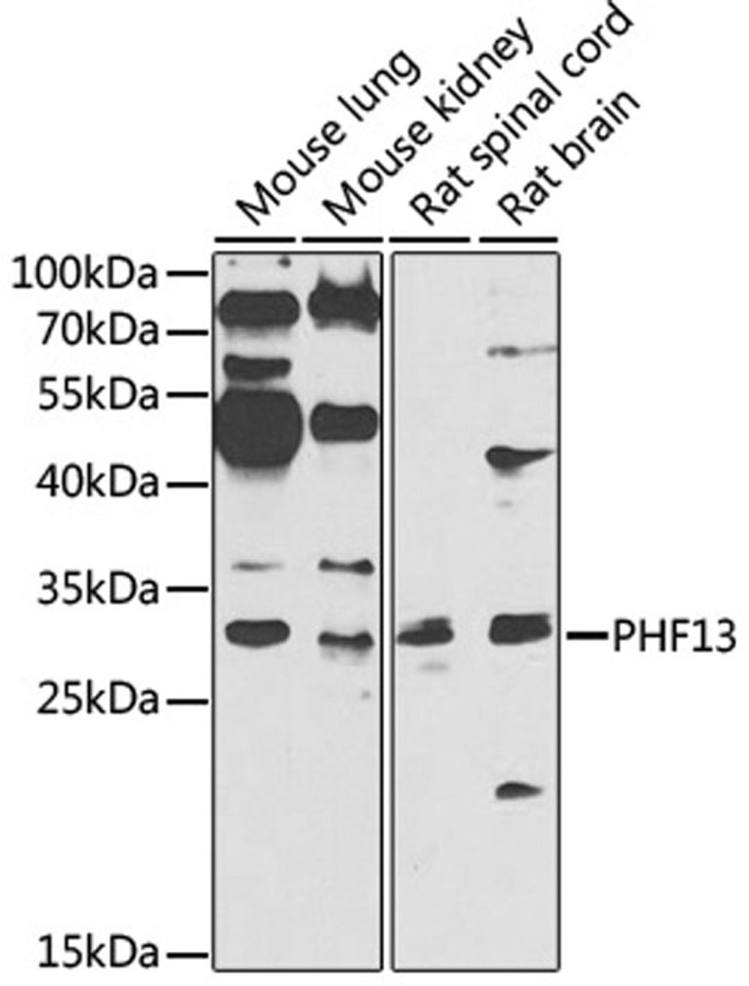 Western blot - PHF13 antibody (A7854)