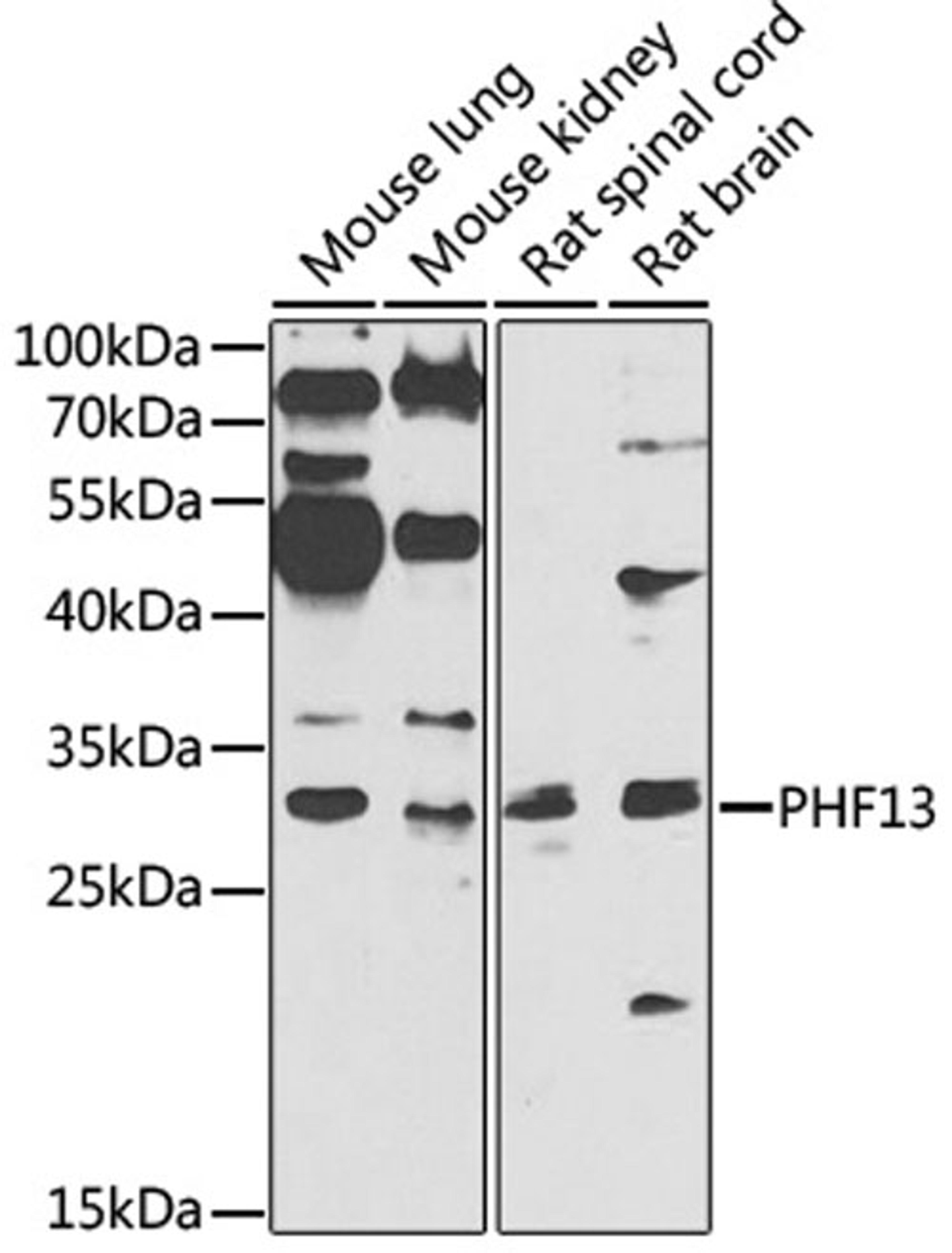 Western blot - PHF13 antibody (A7854)