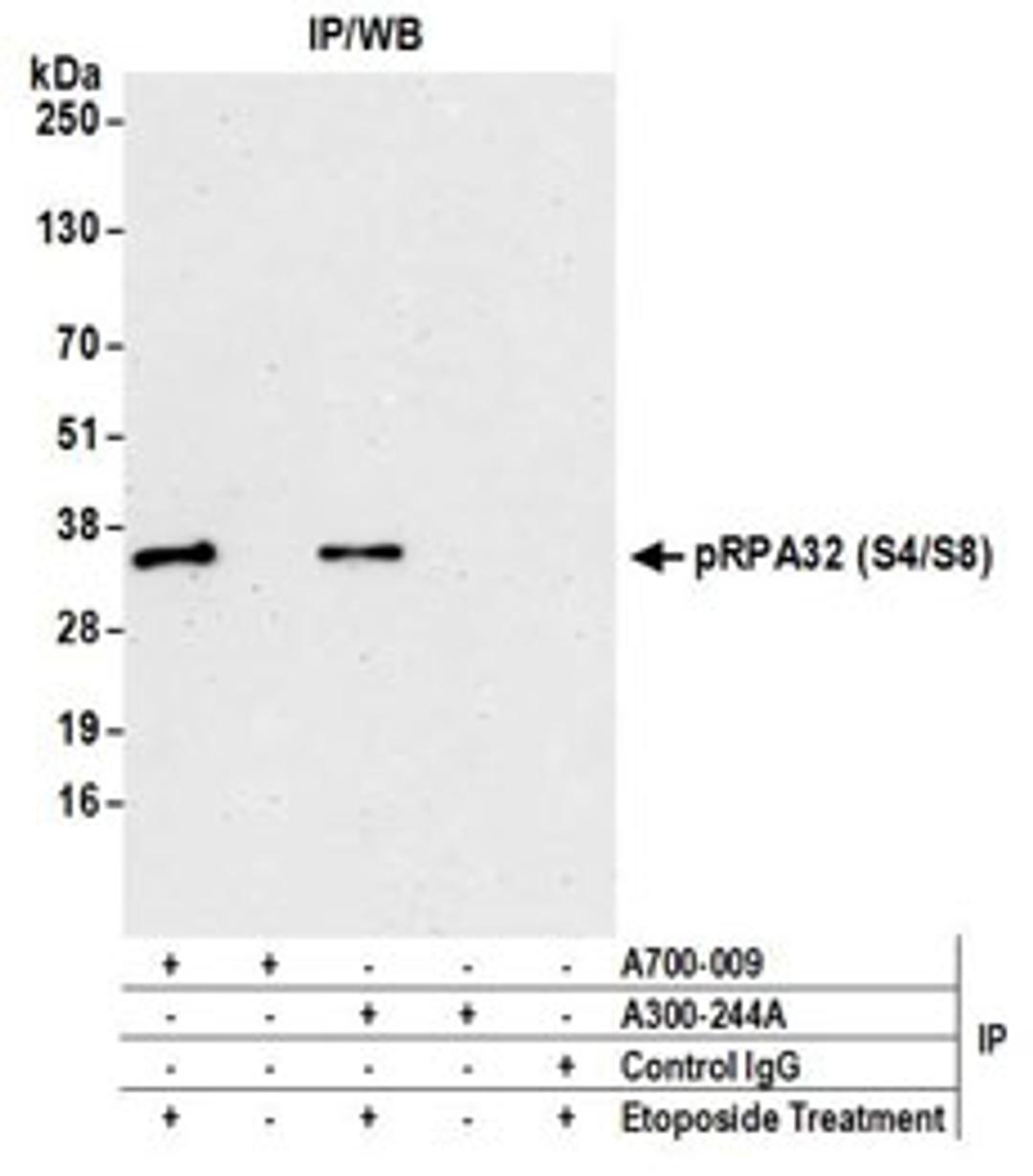 Detection of human Phospho RPA32 (S4/S8) by western blot of immunoprecipitates.