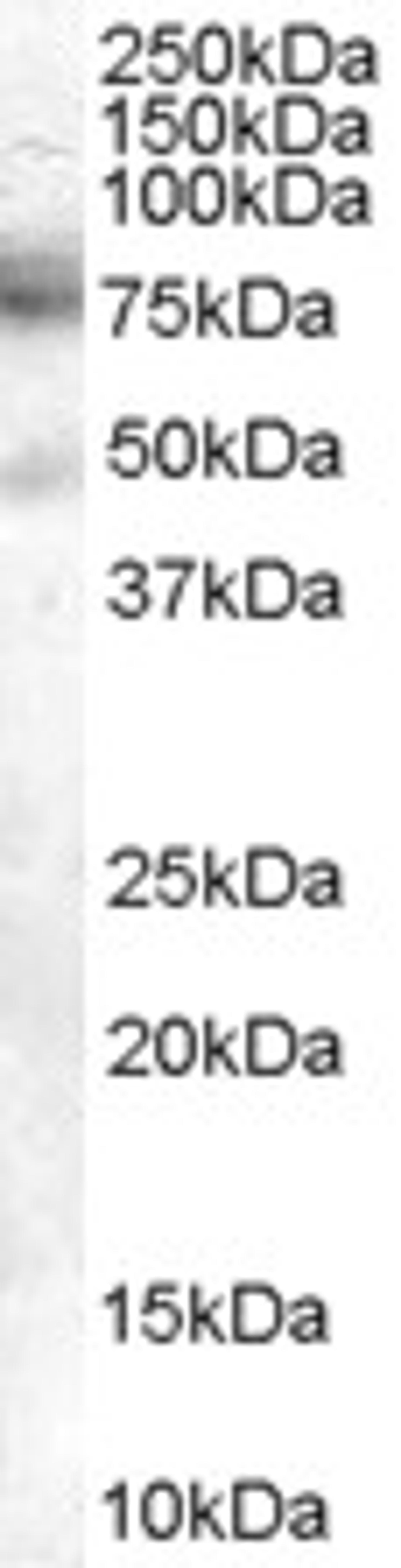 45-467 (2ug/ml) staining of A431 cell lysate (35ug protein in RIPA buffer). Primary incubation was 1 hour. Detected by chemiluminescence.