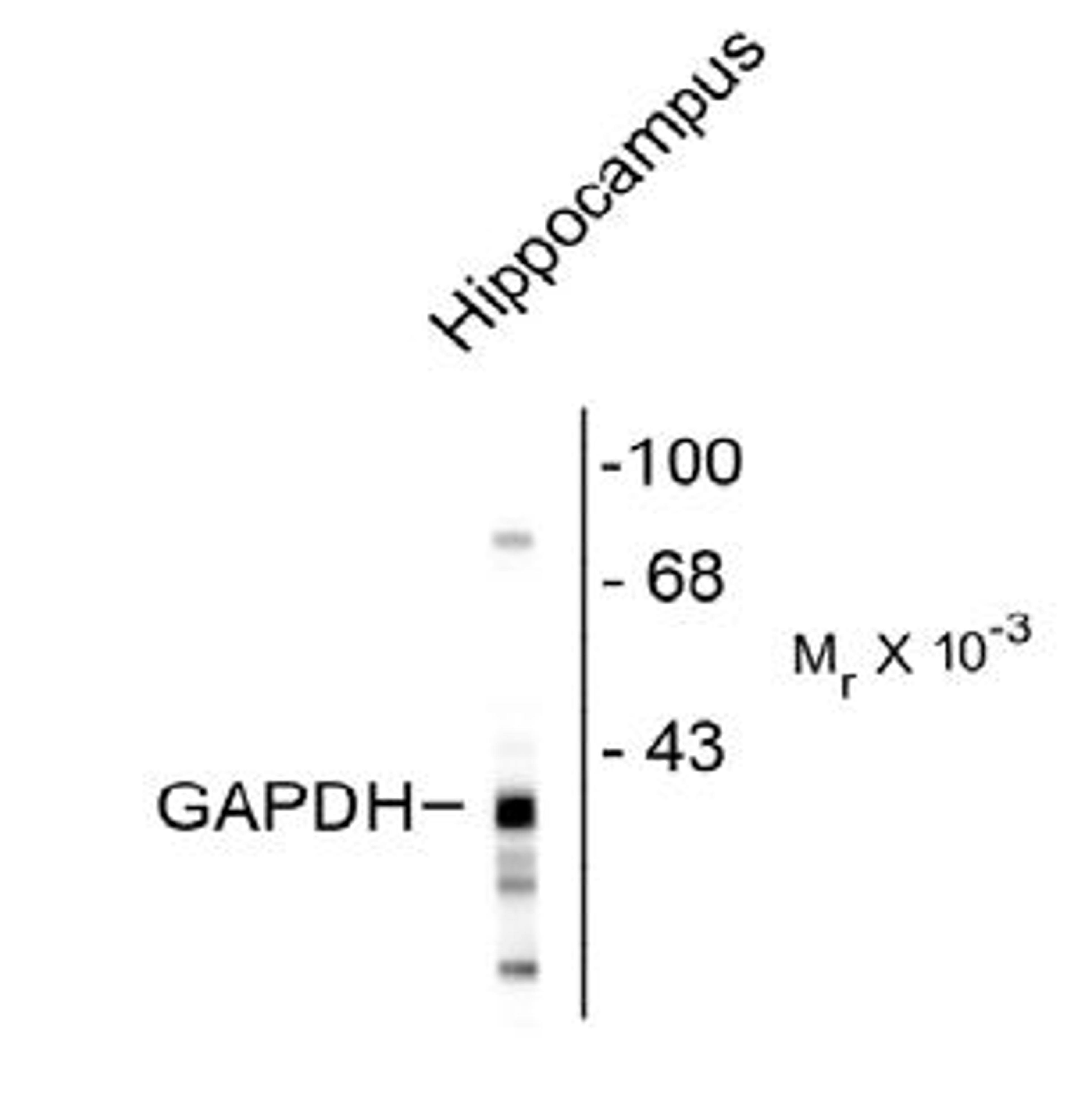 Western blot of rat hippocampal lysate showing the immunolabeling of ~38k GAPDH protein. <br><br> <b>Below:</b> Human neuroblastoma SH-SY5Y cells stained with mouse anti-GAPDH (green), chicken antibody to neurofilament NF-H (red) and DNA (blue).