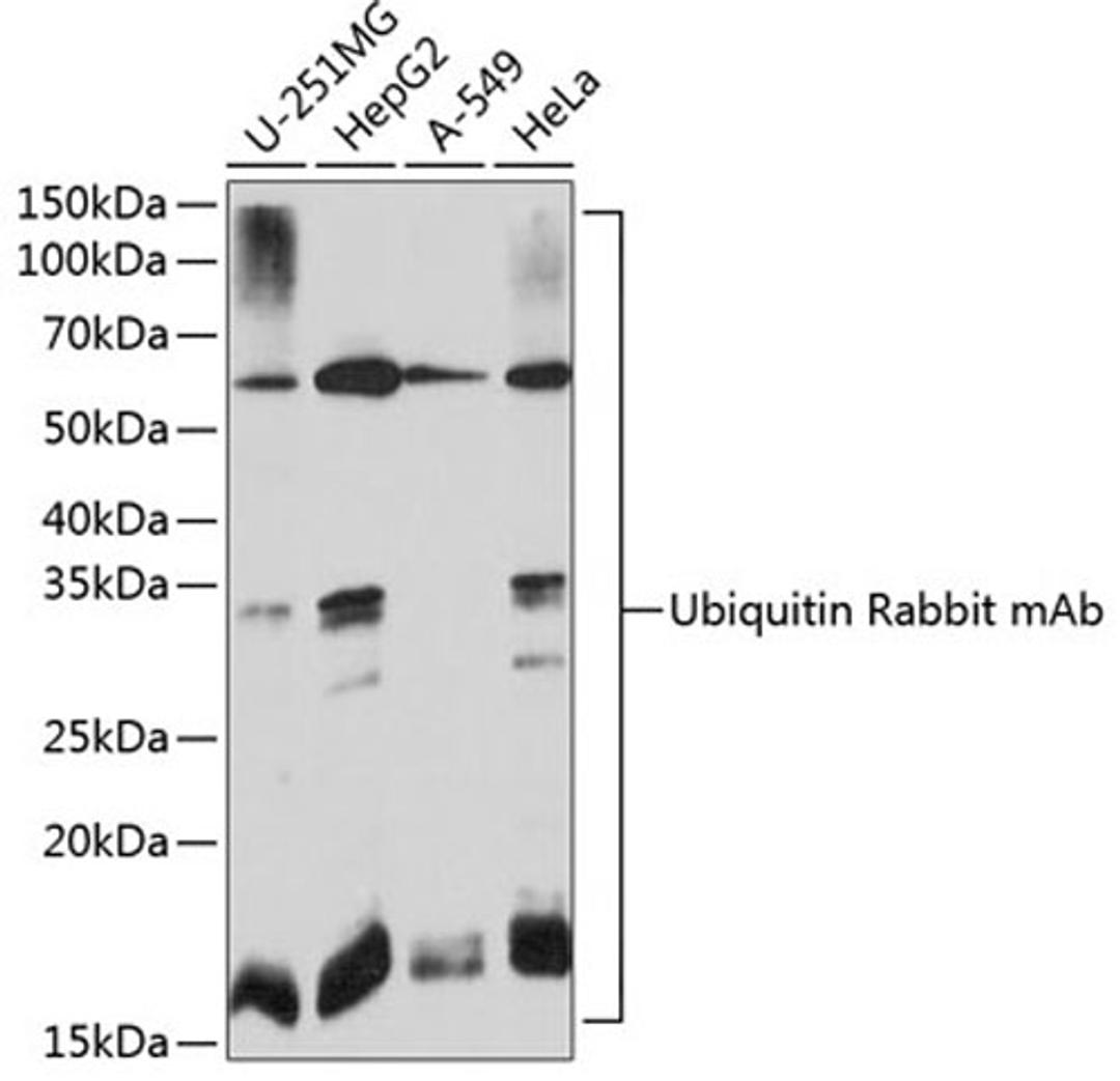 Western blot - Ubiquitin Rabbit mAb (A19686)