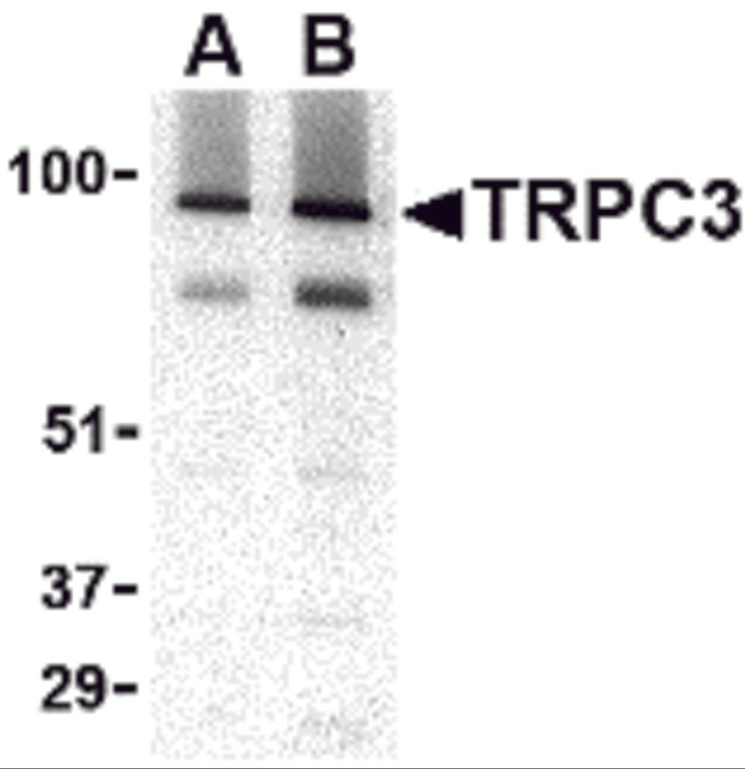 Western blot analysis of TRPC3 in human brain tissue lysate with TRPC3 antibody at (A) 1 and (B) 2 &#956;g/mL.