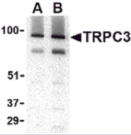 Western blot analysis of TRPC3 in human brain tissue lysate with TRPC3 antibody at (A) 1 and (B) 2 &#956;g/mL.