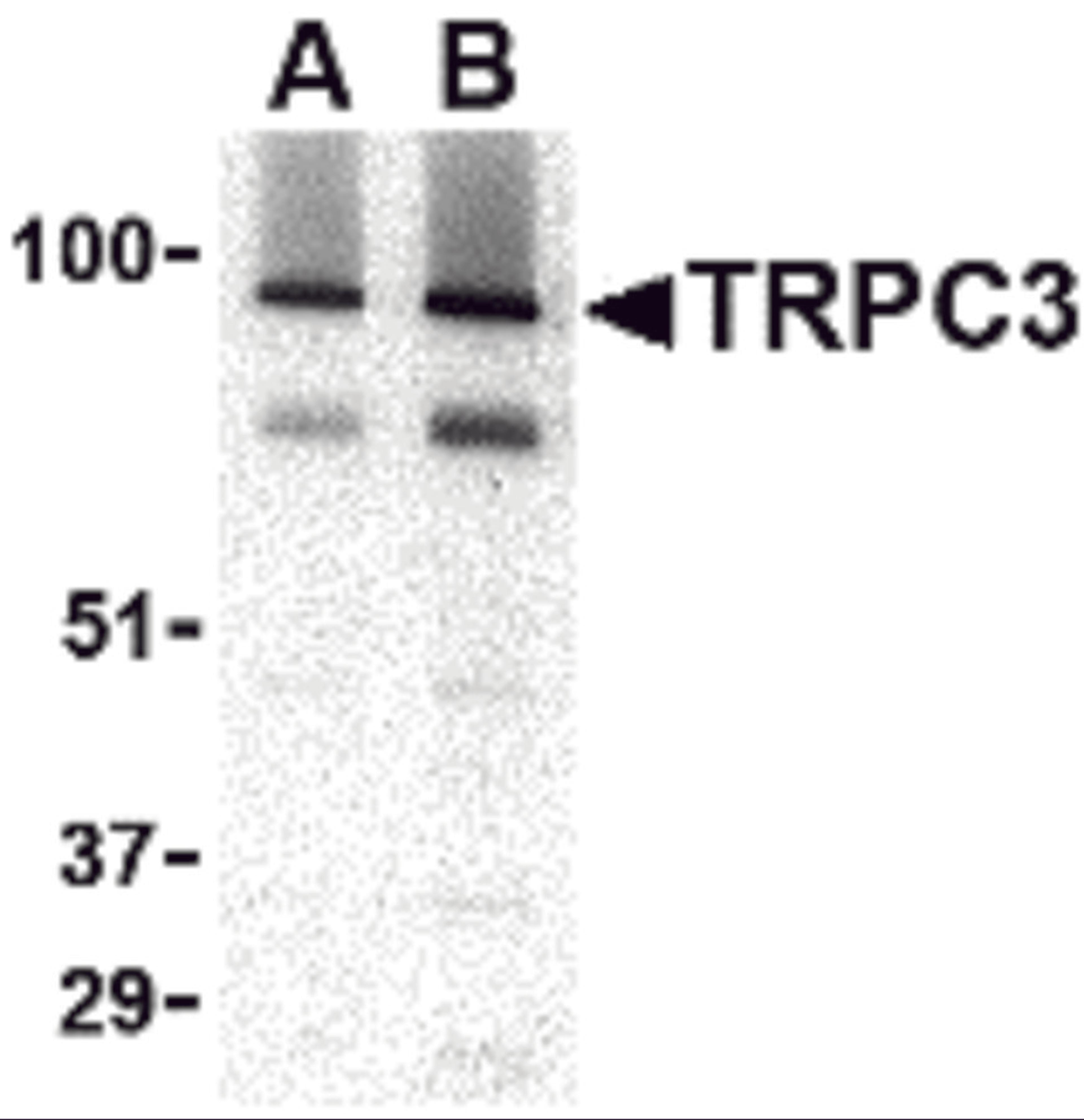 Western blot analysis of TRPC3 in human brain tissue lysate with TRPC3 antibody at (A) 1 and (B) 2 &#956;g/mL.