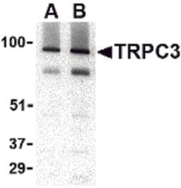 Western blot analysis of TRPC3 in human brain tissue lysate with TRPC3 antibody at (A) 1 and (B) 2 μg/mL.