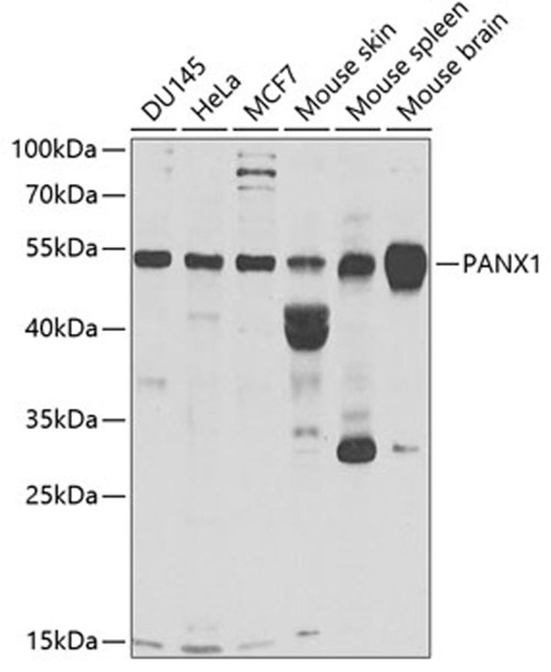 Western blot - PANX1 antibody (A6683)