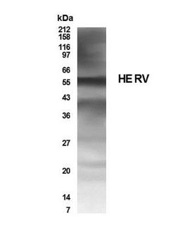 Western Blot: HERV Antibody [NB100-93579] - WB detection of HERV in human placenta lysate with NB100-93579 antibody at a dilution of 1:250