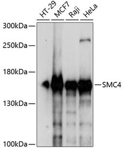 Western blot - SMC4 antibody (A13933)