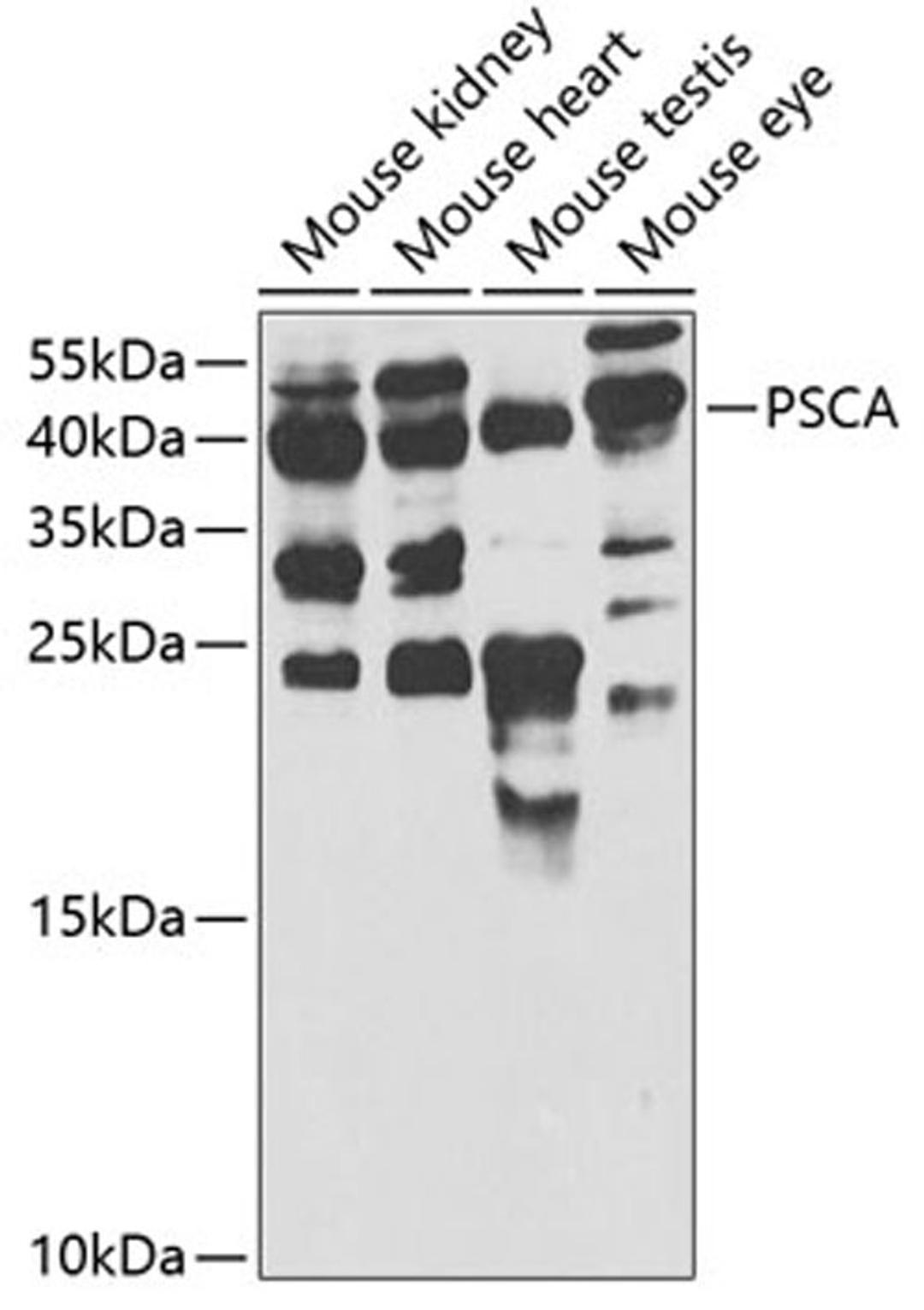 Western blot - PSCA antibody (A5614)