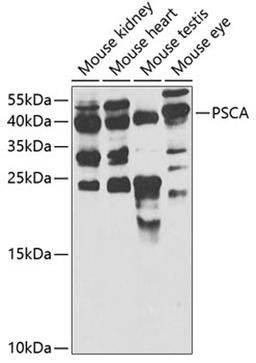 Western blot - PSCA antibody (A5614)