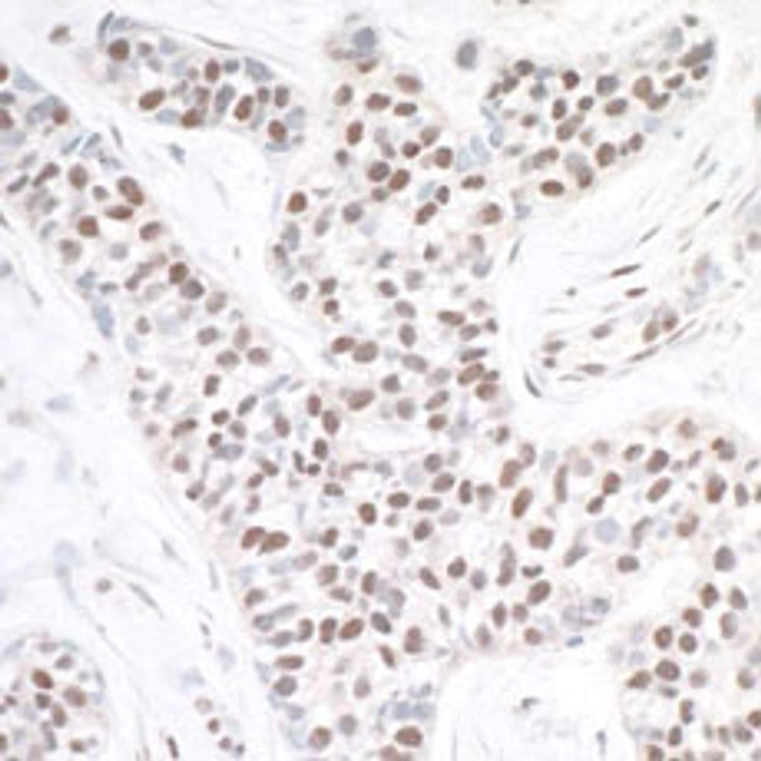 Detection of human ASH2 by immunohistochemistry.