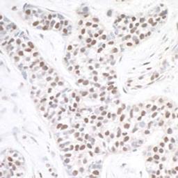 Detection of human ASH2 by immunohistochemistry.