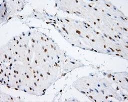 Immunohistochemistry-Paraffin: SHC1 Antibody (3A1) [NBP2-02434] - Staining of paraffin-embedded bladder tissue using anti-SHC1 mouse monoclonal antibody.