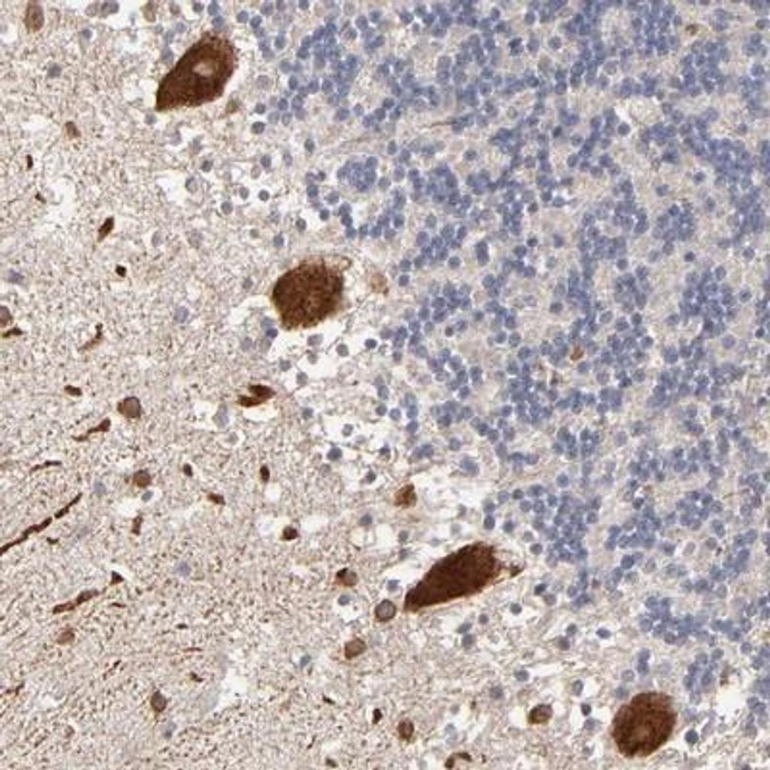 Immunohistochemistry: Steroid sulfatase Antibody [NBP1-90095] - Staining of human cerebellum shows strong cytoplasmic positivity in purkinje cells.