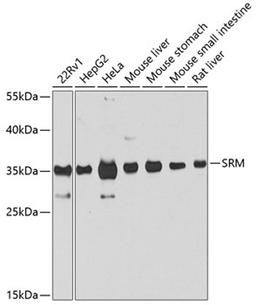 Western blot - SRM antibody (A8151)