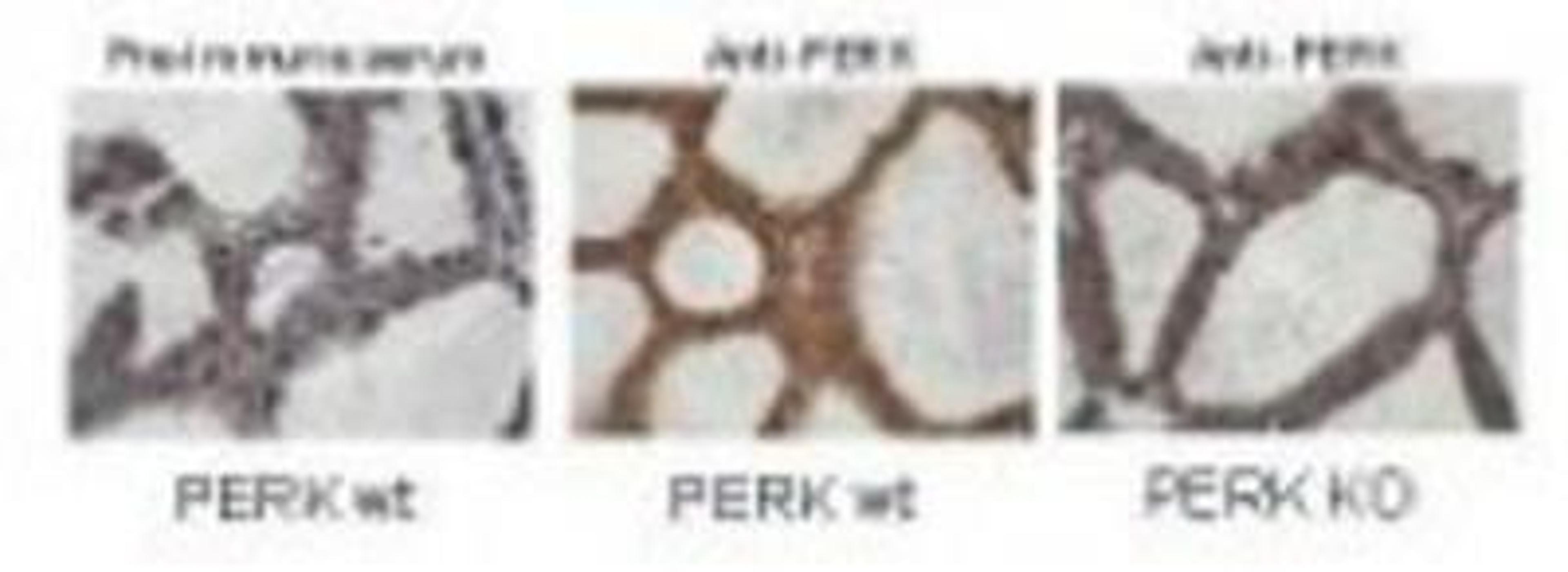 Immunohistochemistry-Paraffin: PERK Antibody [NBP1-78017] - Immunohistochemistry staining of mouse mammary gland samples from lactating mice (L10) with anti-PERK. Positive staining signal observed in wild type mouse sample with anti-PERK staining only (middle image), but not in the knock out mouse sample (right image) and pre-immune serum staining (left image) The anti-PERK was diluted 1:1,000 in 5% goat serum in PBS and allowed to incubate for 2h at room temperature in a humidified chamber. Personal Communication. A, Diehl, Univ. of Pennsylvania, Philadelphia, PA.