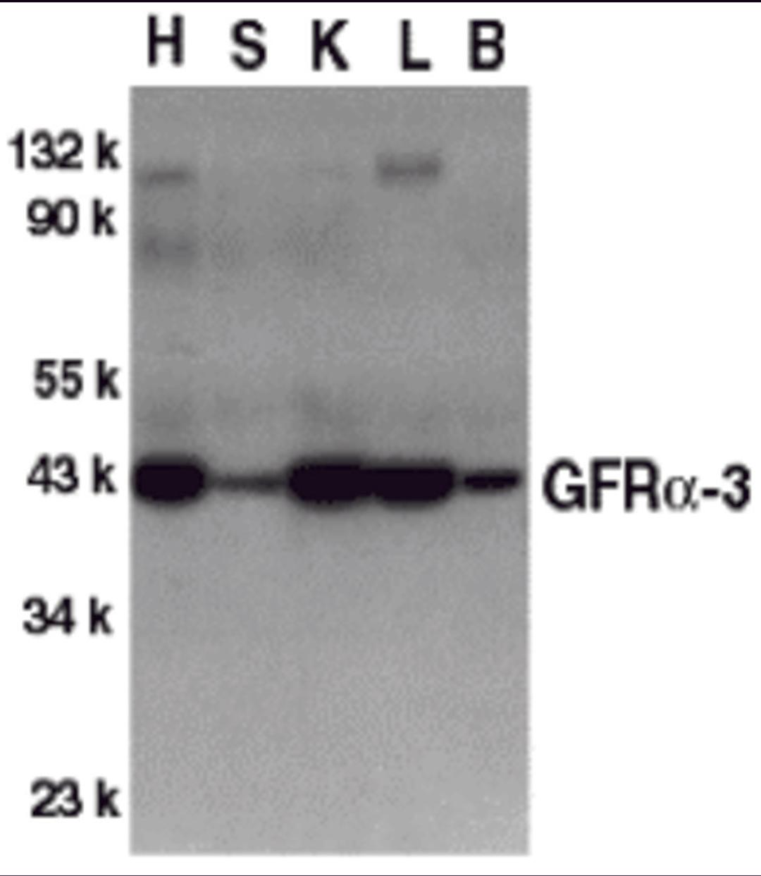 Western blot analysis of GFR alpha 3 in crude cell membrane fractions of mouse heart (H), spleen (S), kidney (K), liver (L), and brain (B), respectively, with GFR alpha 3 antibody at 1 2 &#956;g/mL.