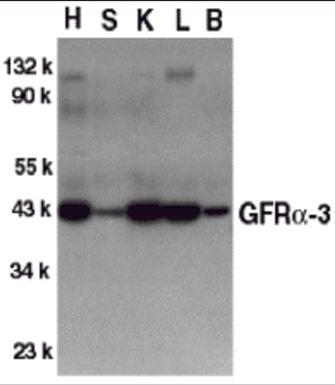 Western blot analysis of GFR alpha 3 in crude cell membrane fractions of mouse heart (H), spleen (S), kidney (K), liver (L), and brain (B), respectively, with GFR alpha 3 antibody at 1 2 μg/mL.