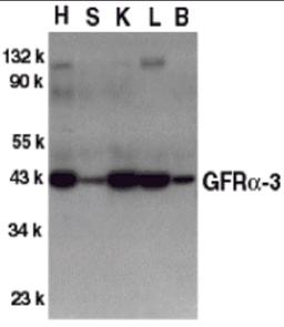 Western blot analysis of GFR alpha 3 in crude cell membrane fractions of mouse heart (H), spleen (S), kidney (K), liver (L), and brain (B), respectively, with GFR alpha 3 antibody at 1 2 μg/mL.