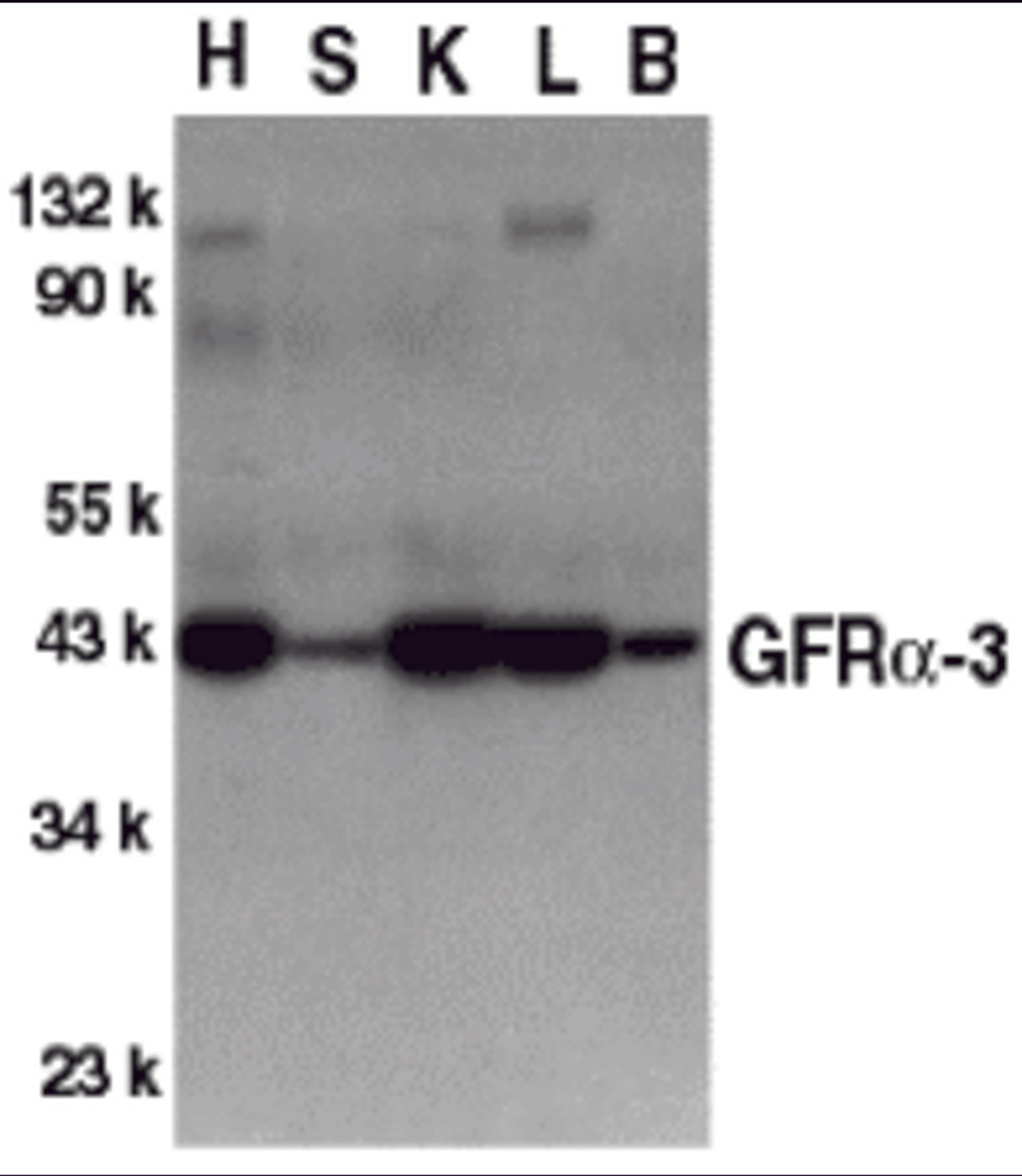 Western blot analysis of GFR alpha 3 in crude cell membrane fractions of mouse heart (H), spleen (S), kidney (K), liver (L), and brain (B), respectively, with GFR alpha 3 antibody at 1 2 μg/mL.