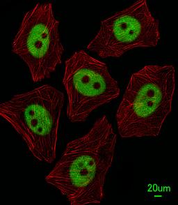 Immunofluorescent analysis of A549 cells, using XRCC1 Antibody . Antibody was diluted at 1:25 dilution. Alexa Fluor 488-conjugated goat anti-rabbit lgG at 1:400 dilution was used as the secondary antibody (green). Cytoplasmic actin was counterstained with