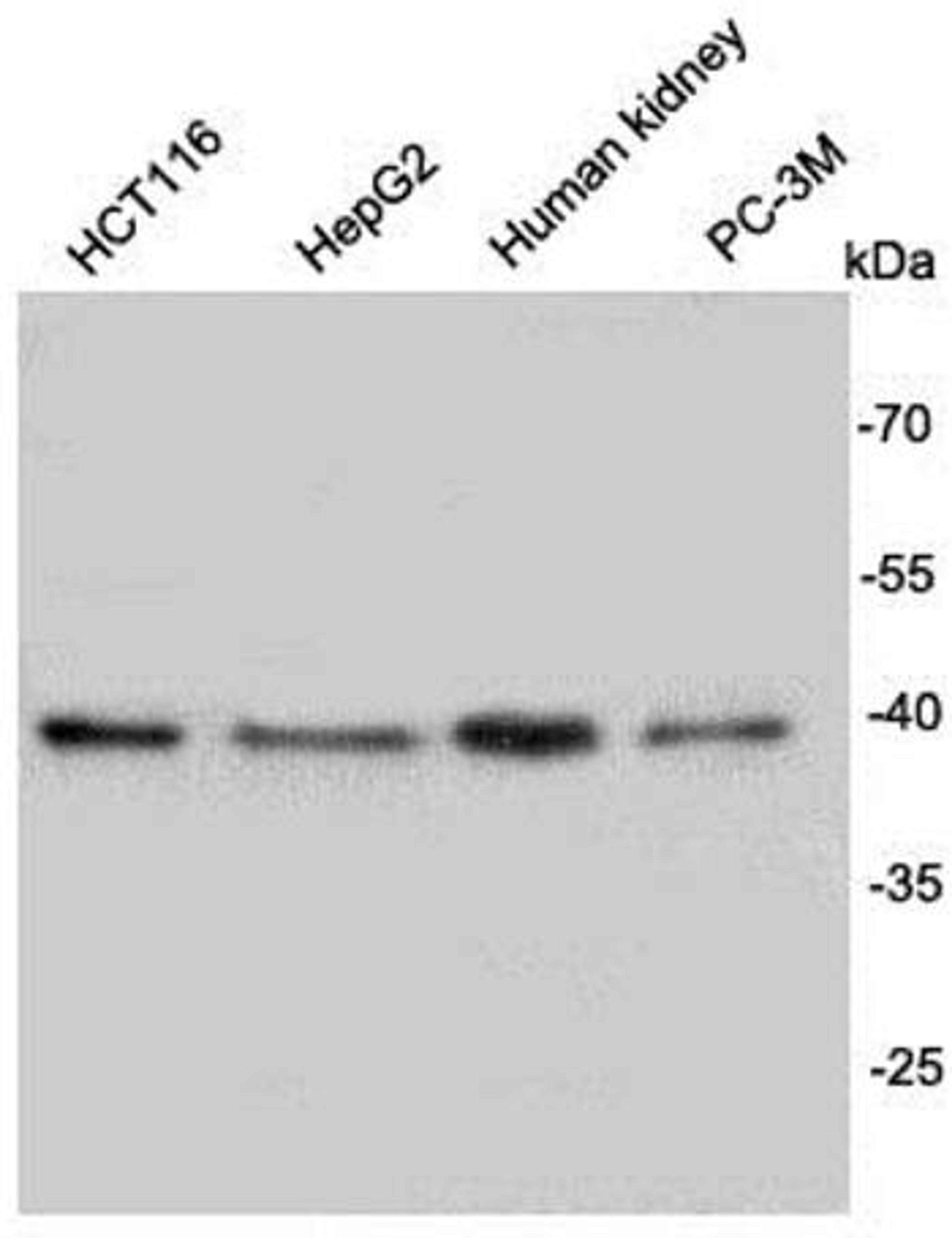 Western blot analysis of different cell lysates using Rem2 antibody