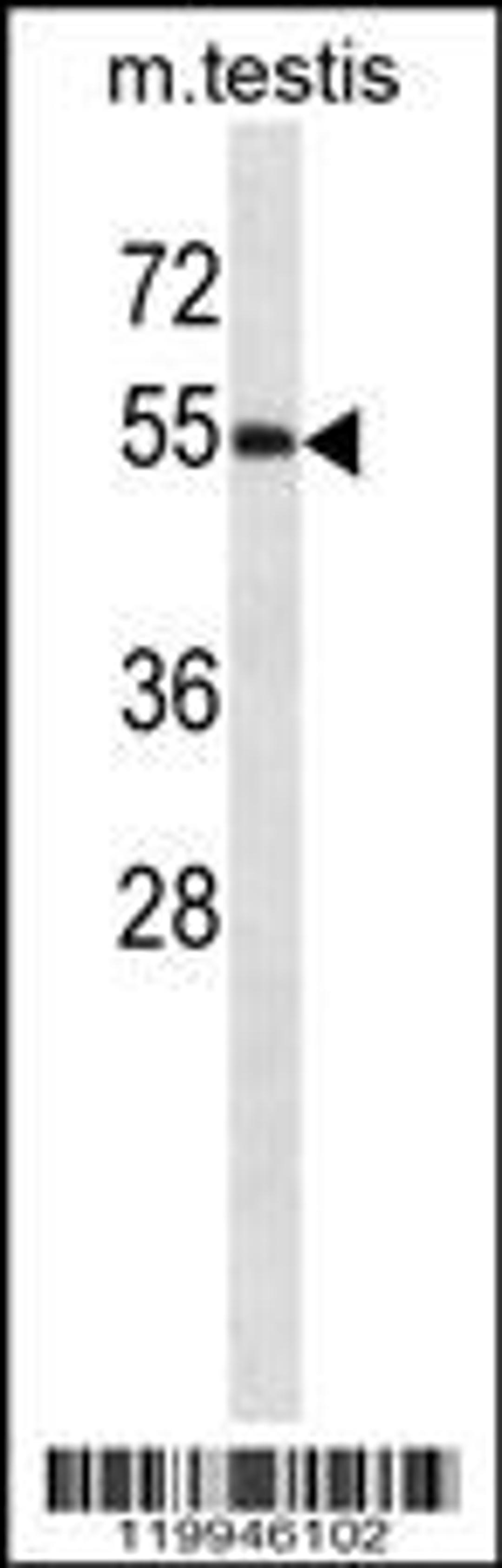 Western blot analysis in mouse testis tissue lysates (35ug/lane).