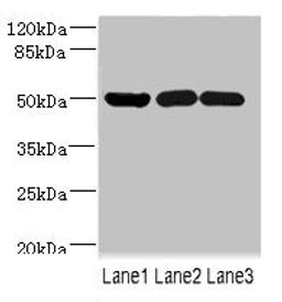 Western blot. All lanes: IFRD1 antibody at 1.76ug/ml. Lane 1: Mouse skeletal muscle tissue. Lane 2: Hela whole cell lysate. Lane 3: Jurkat whole cell lysate. Secondary. Goat polyclonal to rabbit IgG at 1/10000 dilution. Predicted band size: 51, 46 kDa. Observed band size: 51 kDa. 