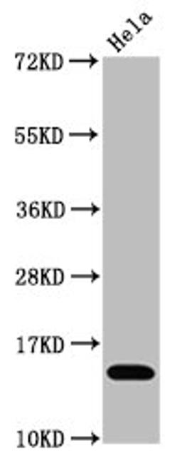 Western Blot. Positive WB detected in Hela whole cell lysate treated by 15mM sodium butyrate for 30min. All lanes Acetyl-Histone H3.1(K4)antibody at 1.1μg/ml. Secondary. Goat polyclonal to rabbit IgG at 1/50000 dilution. Predicted band size: 15 KDa. Observed band size: 15 KDa. 