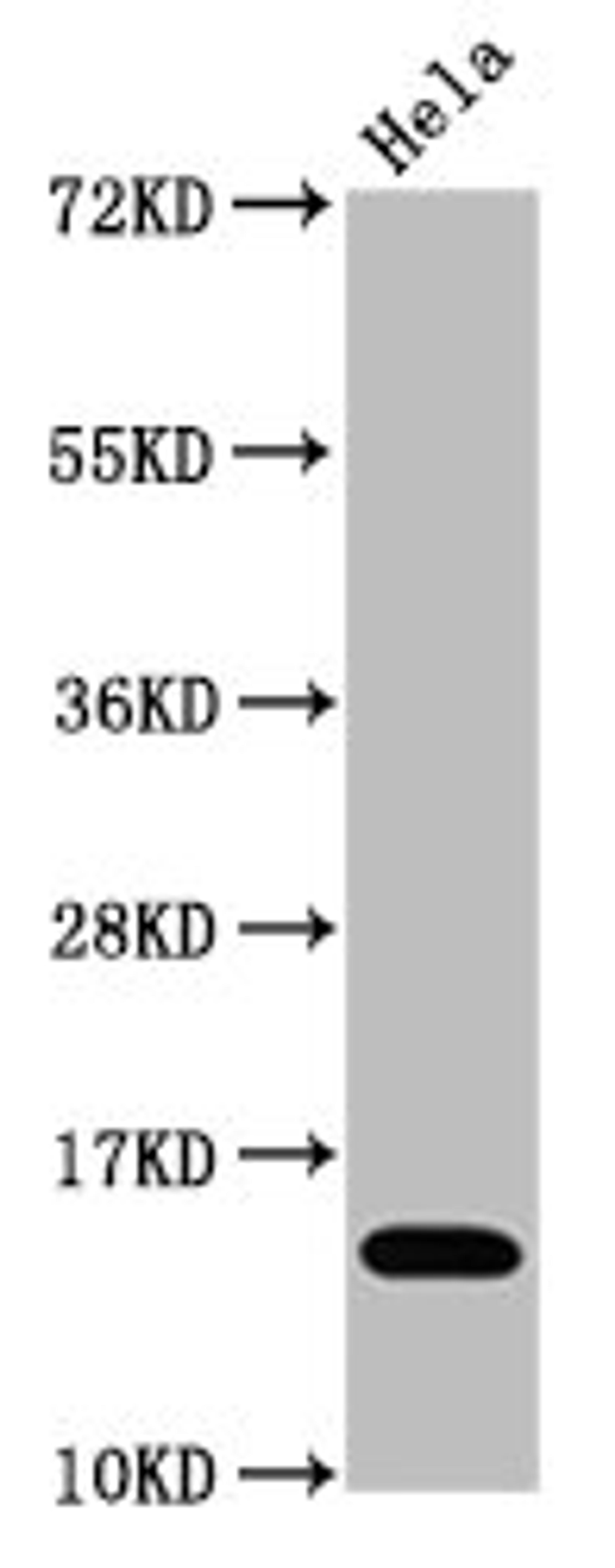 Western Blot. Positive WB detected in Hela whole cell lysate treated by 15mM sodium butyrate for 30min. All lanes Acetyl-Histone H3.1(K4)antibody at 1.1μg/ml. Secondary. Goat polyclonal to rabbit IgG at 1/50000 dilution. Predicted band size: 15 KDa. Observed band size: 15 KDa. 