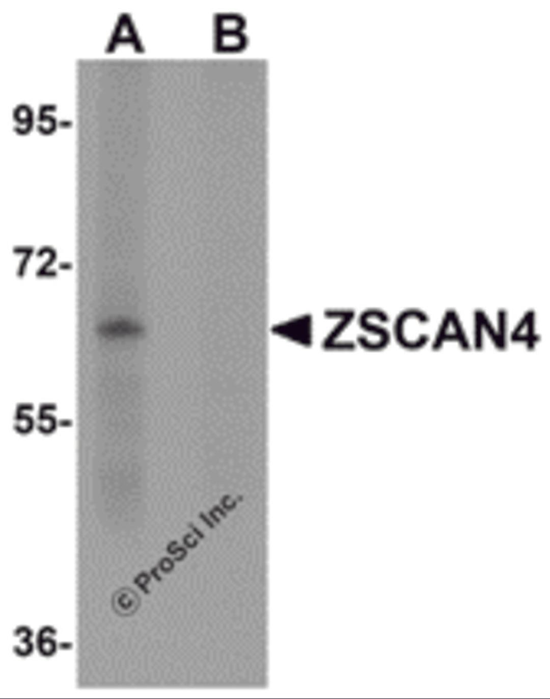 Western blot analysis of ZSCAN4 in mouse lung tissue lysate with ZSCAN4 antibody in (A) the absence and (B) presence of blocking peptide.