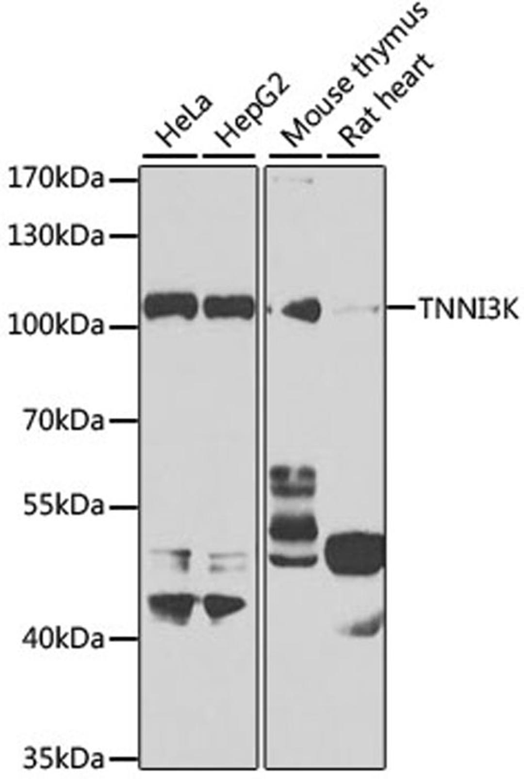 Western blot - TNNI3K antibody (A7802)