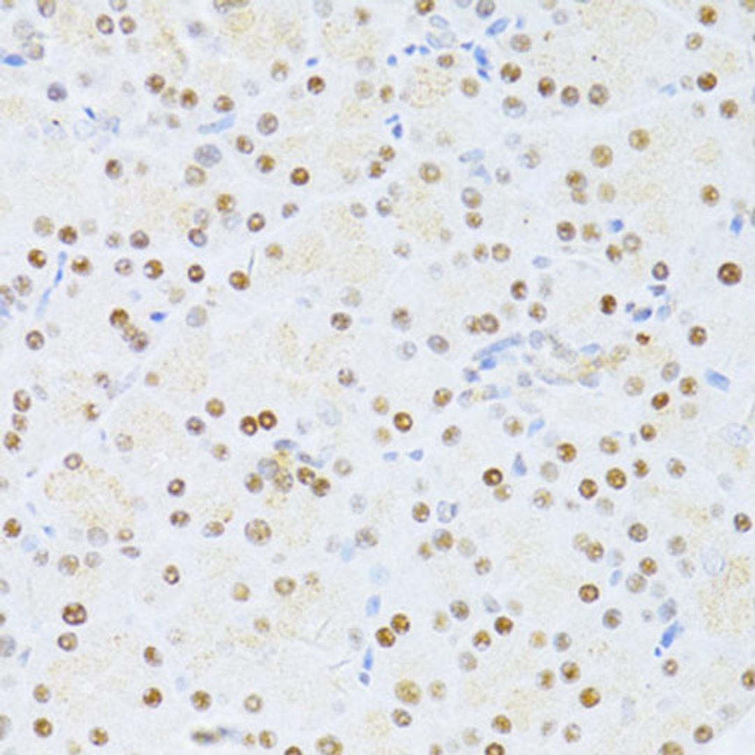 Immunohistochemistry  - ETV1 antibody (A13303)