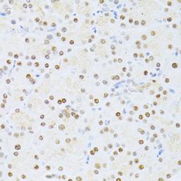 Immunohistochemistry  - ETV1 antibody (A13303)