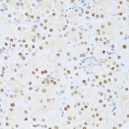 Immunohistochemistry - ETV1 antibody (A13303)