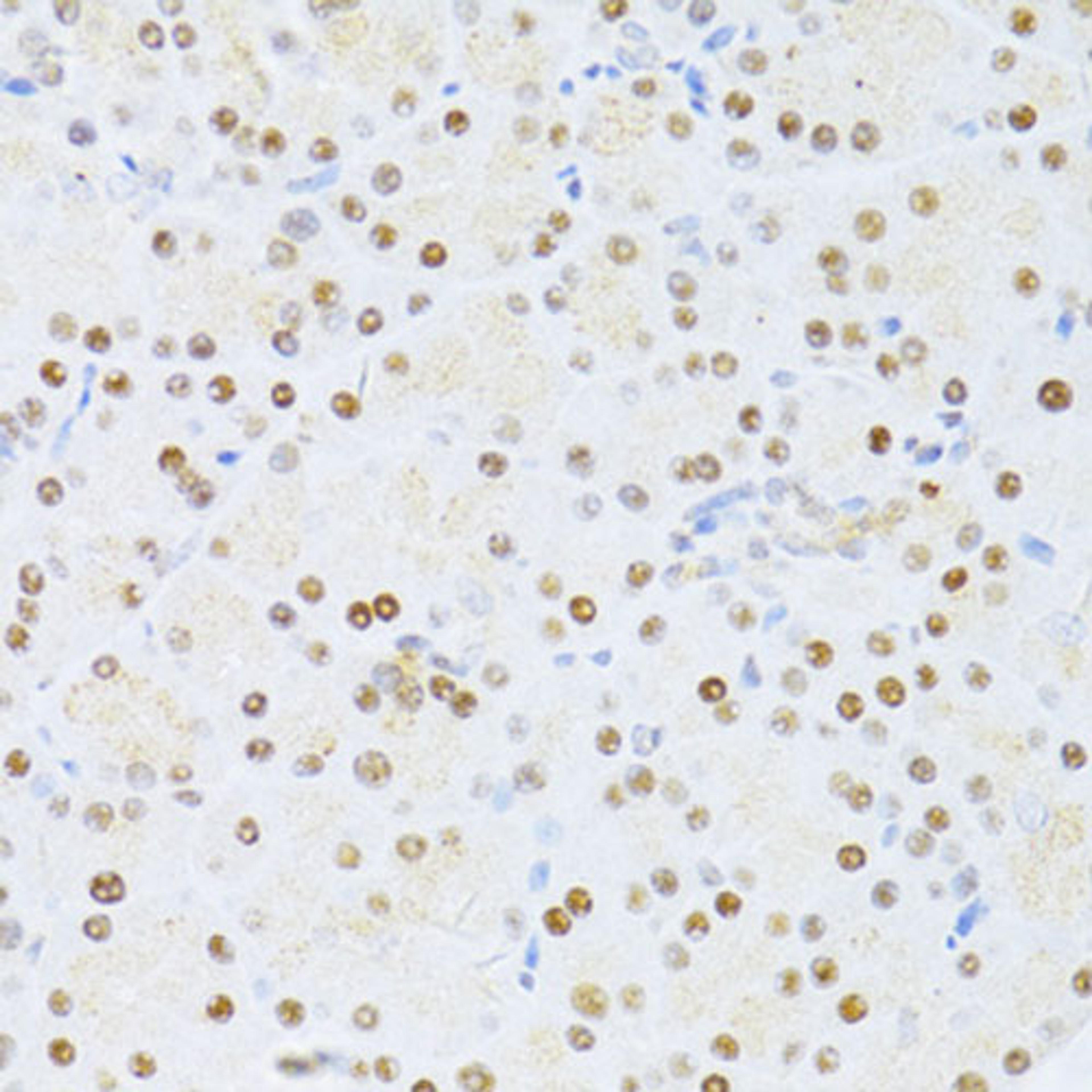 Immunohistochemistry - ETV1 antibody (A13303)
