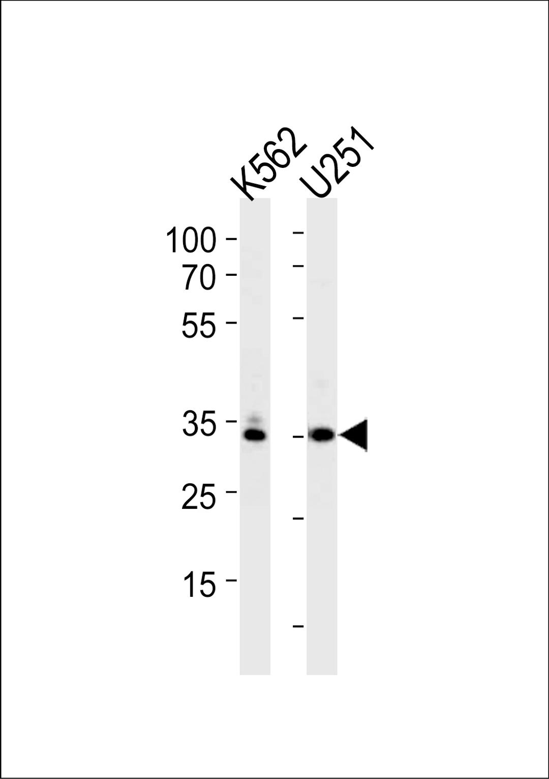 Western blot analysis in K562,U251 cell line lysates (35ug/lane).