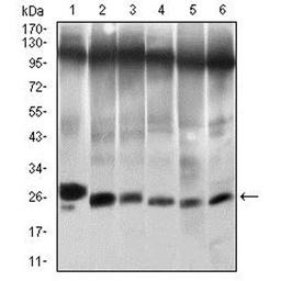 Western blot - Anti-Twist antibody [10E4E6]