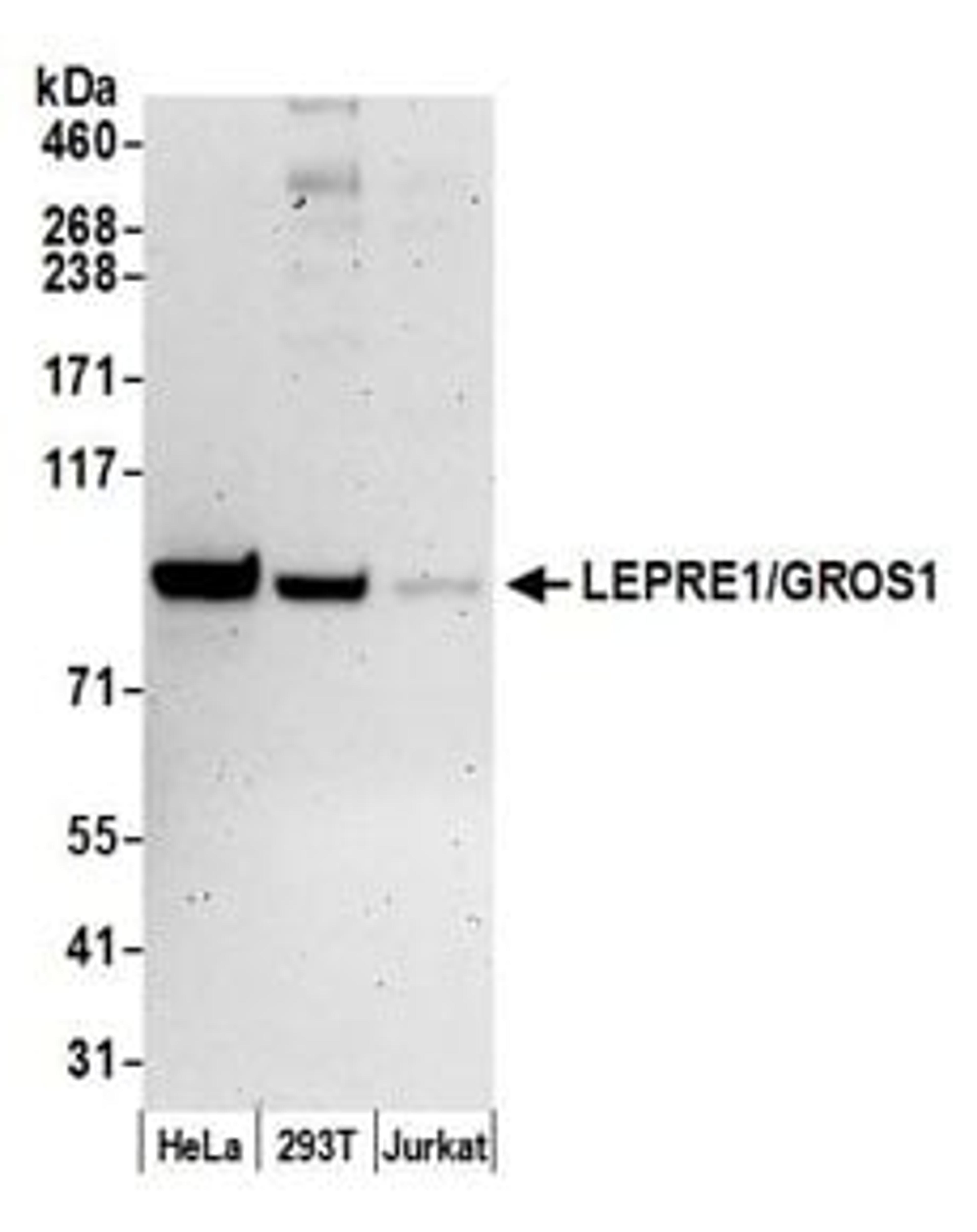 Detection of human LEPRE1/GROS1 by western blot.