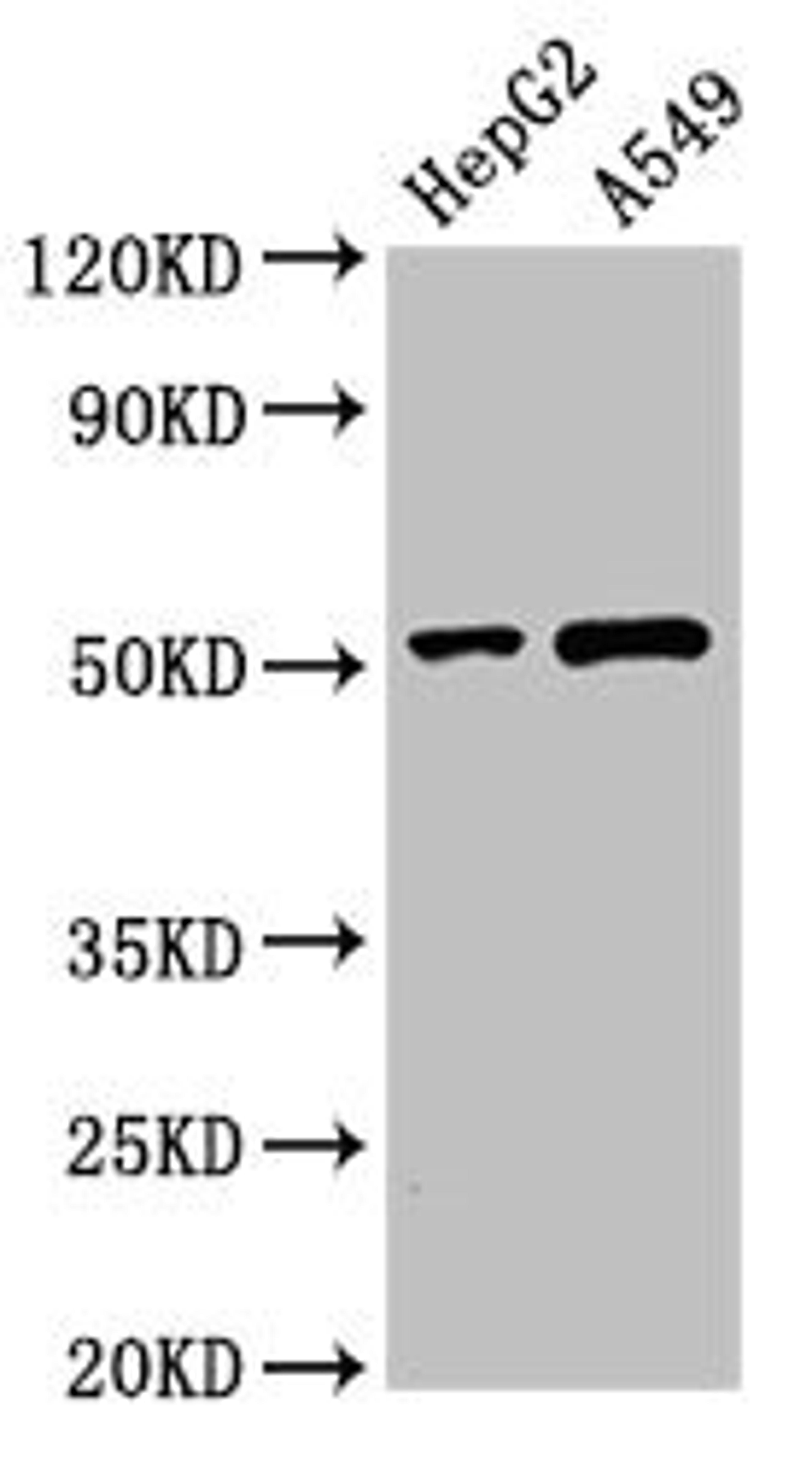 Western Blot. Positive WB detected in: HepG2 whole cell lysate, A549 whole cell lysate. All lanes: PNLIPRP2 antibody at 3µg/ml. Secondary. Goat polyclonal to rabbit IgG at 1/50000 dilution. Predicted band size: 52 kDa. Observed band size: 52 kDa